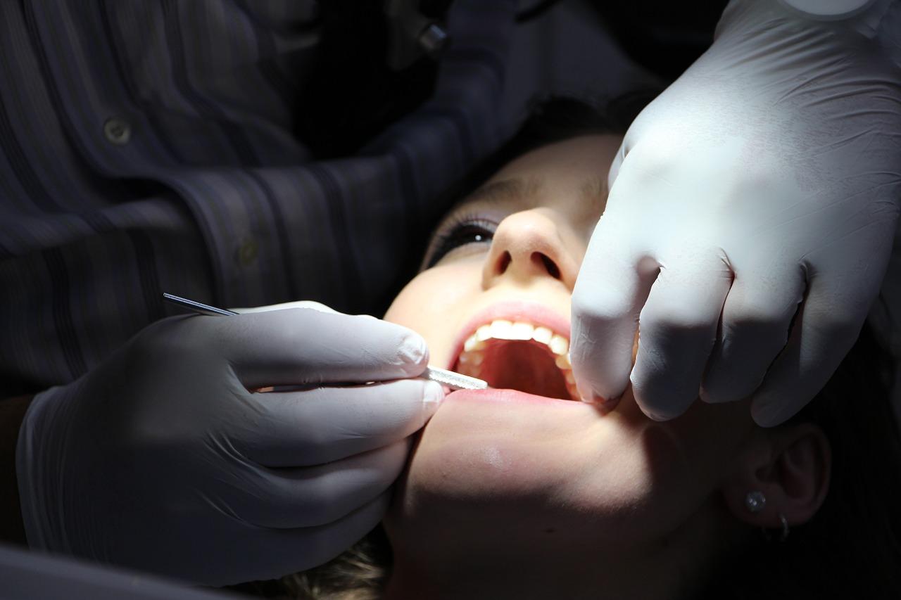 Ile kosztuje i na czym polega fluoryzacja zębów?
